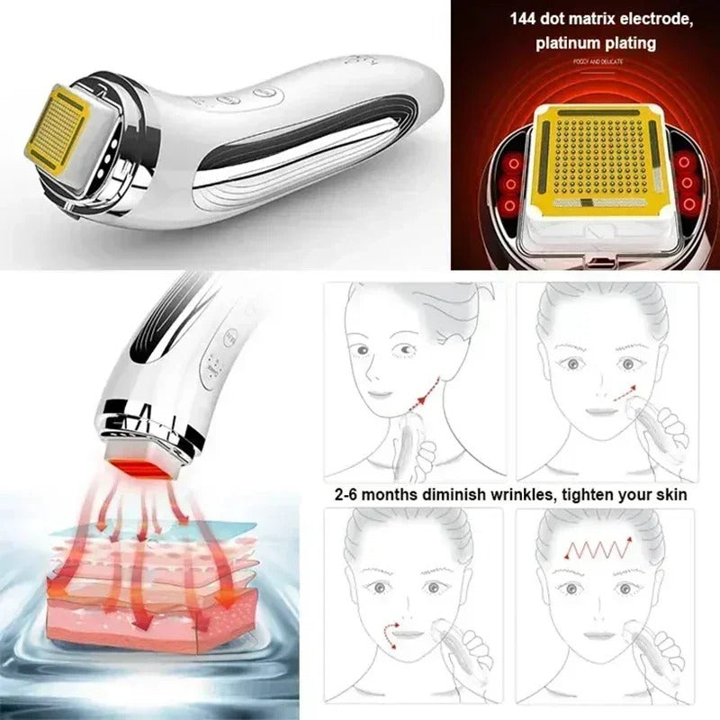 Rechargeable RF Radio Frequency Face Lifter