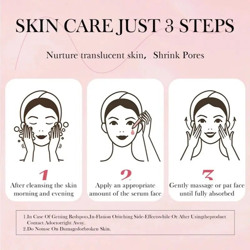 Niacinamide Serum Dark Spot Remover To Fade Acne (30ml)